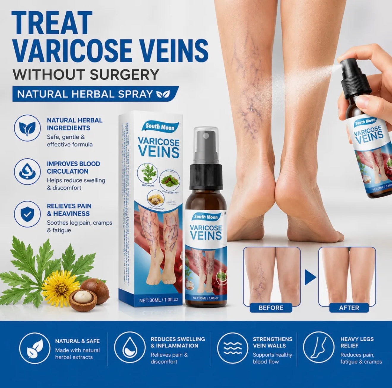 Natural Herbal Varicose Veins Spray South Moon Vein Care Spray 30ml Soothing Relief Formula For Healthy Legs And Improved Circulation